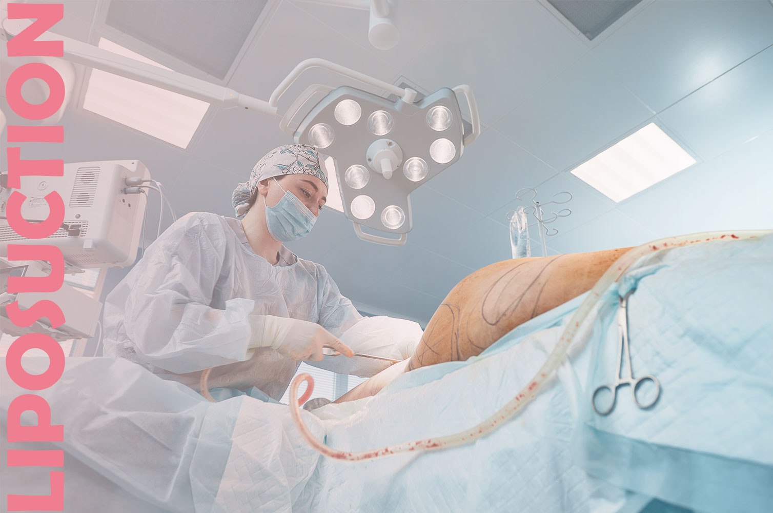 Liposuction Operation In Turkey