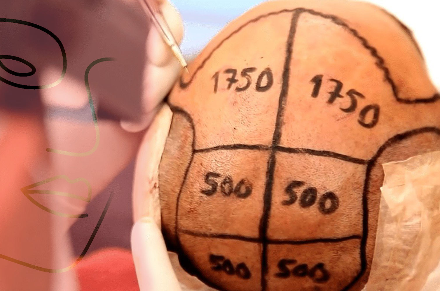 Hair Transplantation in Turkey